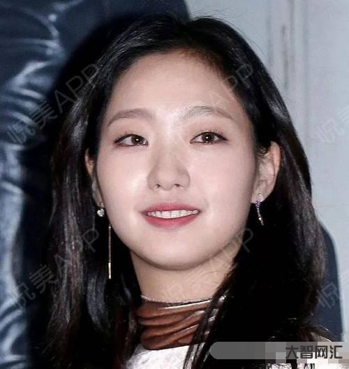 眼睛腫眼泡怎么消除