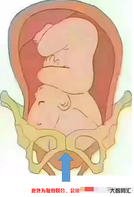 恥骨高女人是什么原因