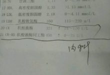 肌酸激酶高是怎么回事-肌酸激酶高是什么原因引起的-大智網(wǎng)匯