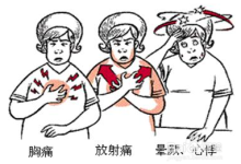 冠心病的癥狀表現在哪些方面-冠心病有什么特征癥狀?-大智網匯