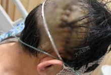網曝河南 59 歲醫生上班期間被捅數刀,院方稱「確有此事」,哪些信息需關注?如何有效保障醫護人員安全?-大智網匯