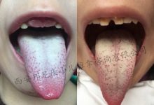 舌頭上有白苔是什么原因-舌苔白是怎么回事?-大智網匯