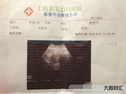 1、懷孕一個(gè)月內(nèi)如何打胎?