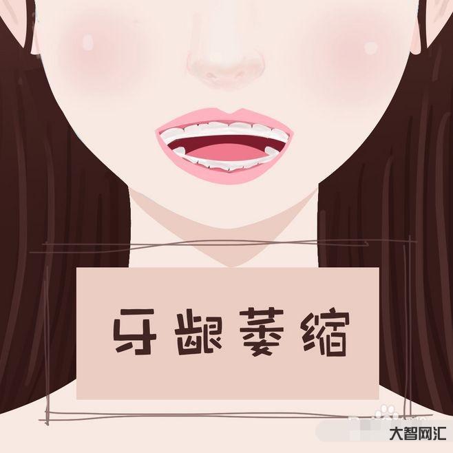 2、如何修復(fù)牙齦萎縮?