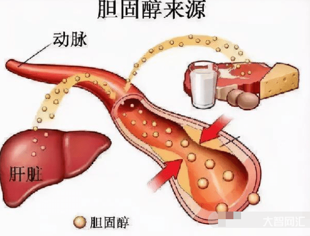 2、高膽固醇怎么了?