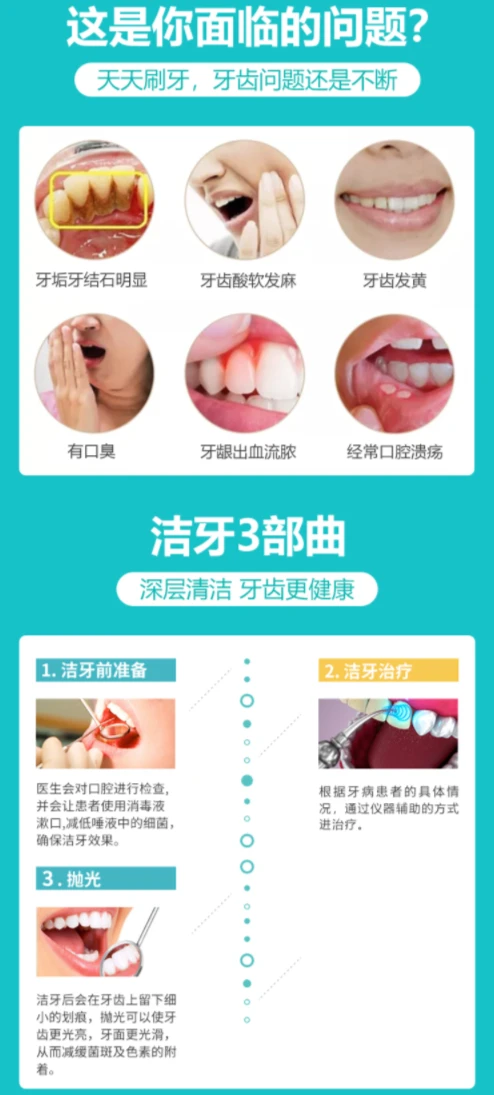 2、洗一次牙要多少錢?洗一次要多長時間?