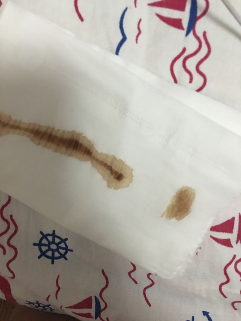 1、月經量少而黑的原因是什么?