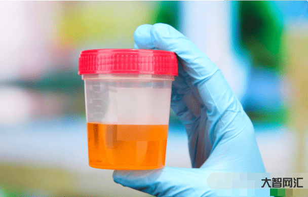 血脂跟血肌酐一樣嗎-血肌酐高了不要怕，這5個指標尚可的腎病也可以與尿毒