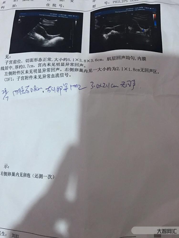 2、子宮內(nèi)膜多厚正常