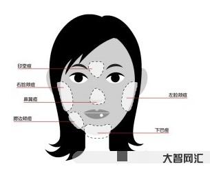 1、下巴痤瘡的原因及調理方法