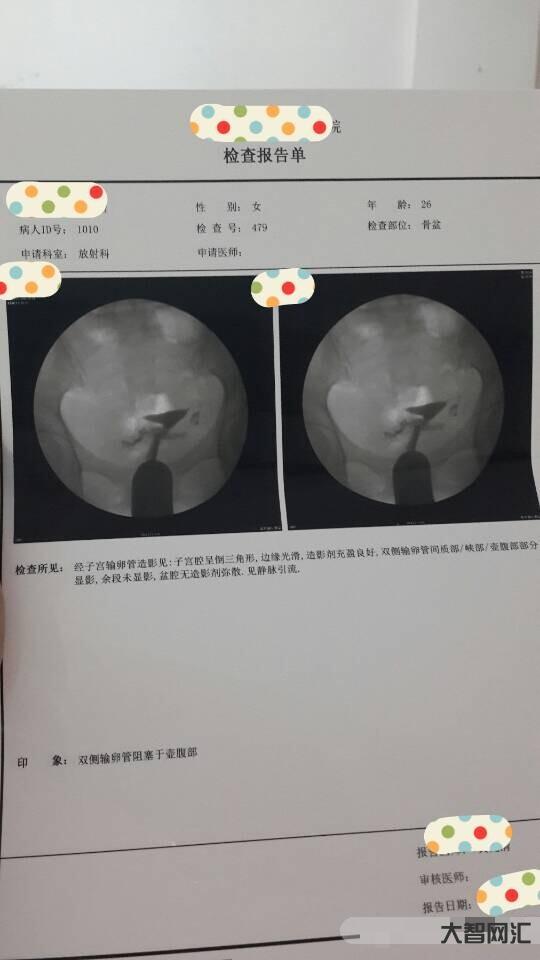 輸卵管堵塞有什么樣癥狀-做輸卵管造影很疼嗎?危害大嗎? 輸卵管堵塞有什么樣癥狀-做輸卵管造影很疼嗎?危害大嗎?