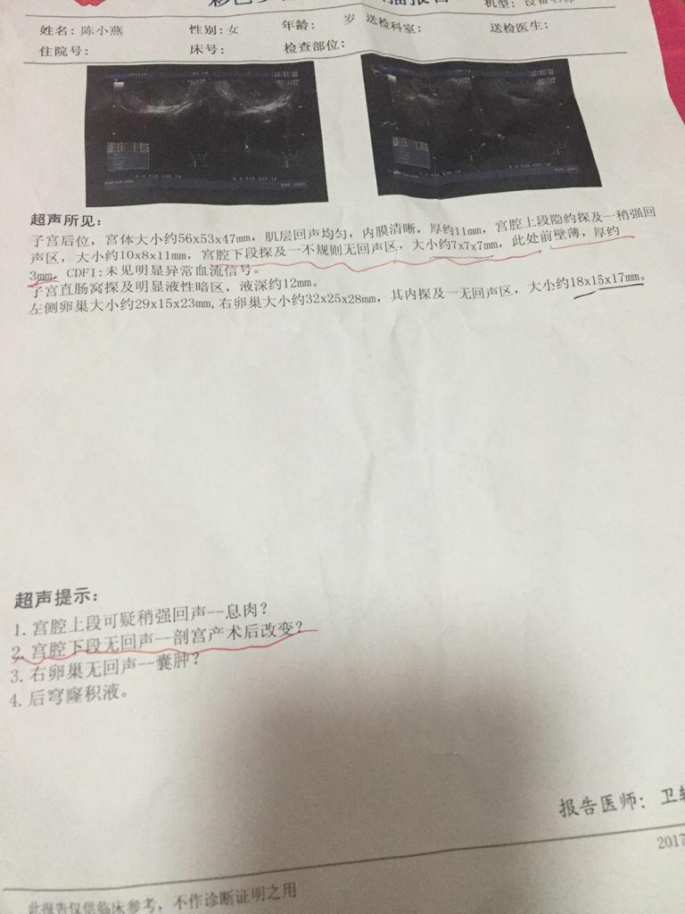 積水多久能排干凈啊-廣東韶關(guān)多鎮(zhèn)出現(xiàn)強(qiáng)降雨,有村里積水深達(dá)1米,轉(zhuǎn)移上 積水多久能排干凈啊-廣東韶關(guān)多鎮(zhèn)出現(xiàn)強(qiáng)降雨,有村里積水深達(dá)1米,轉(zhuǎn)移上