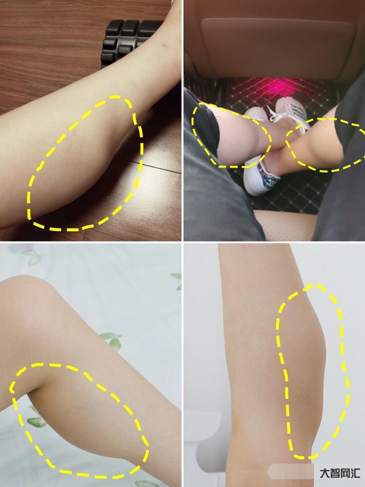 為什么腿的肌肉好緊繃繃的-我是因為胯大才腿粗?今天才知道減掉粗大腿得先 為什么腿的肌肉好緊繃繃的-我是因為胯大才腿粗?今天才知道減掉粗大腿得先