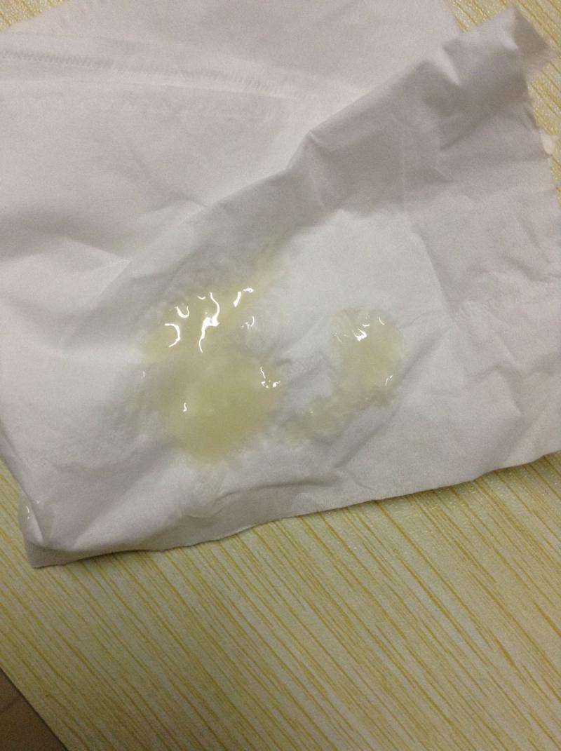 遺精顏色是黃的-每個月遺精幾次會對身體有害嗎?避免4種方式,科學用藥治 遺精顏色是黃的-每個月遺精幾次會對身體有害嗎?避免4種方式,科學用藥治