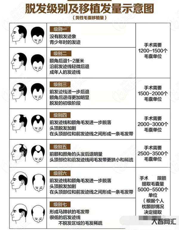 植發要多少錢一般-印度男子植發,把命搭進去?為一頭秀發,窮人只能去黑診 植發要多少錢一般-印度男子植發,把命搭進去?為一頭秀發,窮人只能去黑診