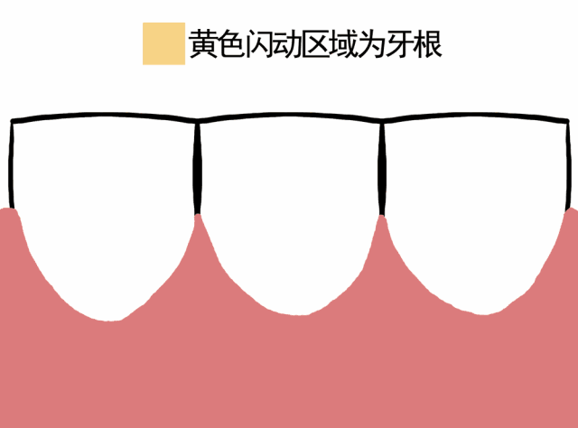 牙齦萎縮怎么恢復-牙齦萎縮該怎么辦呢? 牙齦萎縮怎么恢復-牙齦萎縮該怎么辦呢?