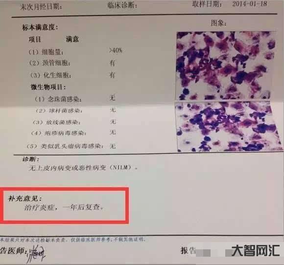 tct檢查什么項目-宮頸炎應該做什么檢查