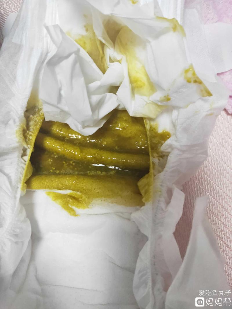 拉肚子拉稀水怎么解決-急性腹瀉怎么辦?醫生支招 拉肚子拉稀水怎么解決-急性腹瀉怎么辦?醫生支招