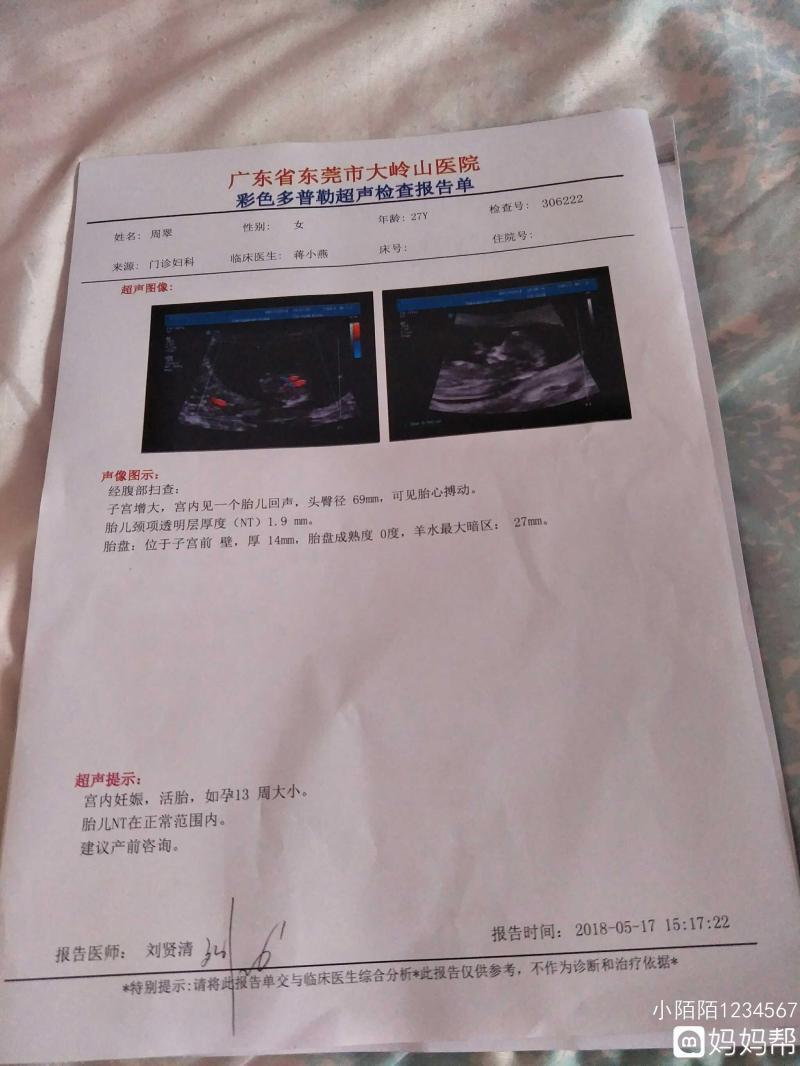 nt檢查什么內容-「婦幼科普」NT報告看不懂?超聲醫學專家為您解讀 nt檢查什么內容-「婦幼科普」NT報告看不懂?超聲醫學專家為您解讀
