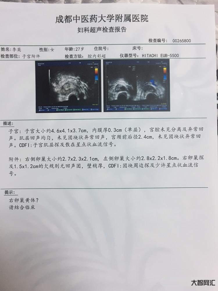 子宮內膜厚度多少正常-【女性頻道】子宮內膜ABC 子宮內膜厚度多少正常-【女性頻道】子宮內膜ABC