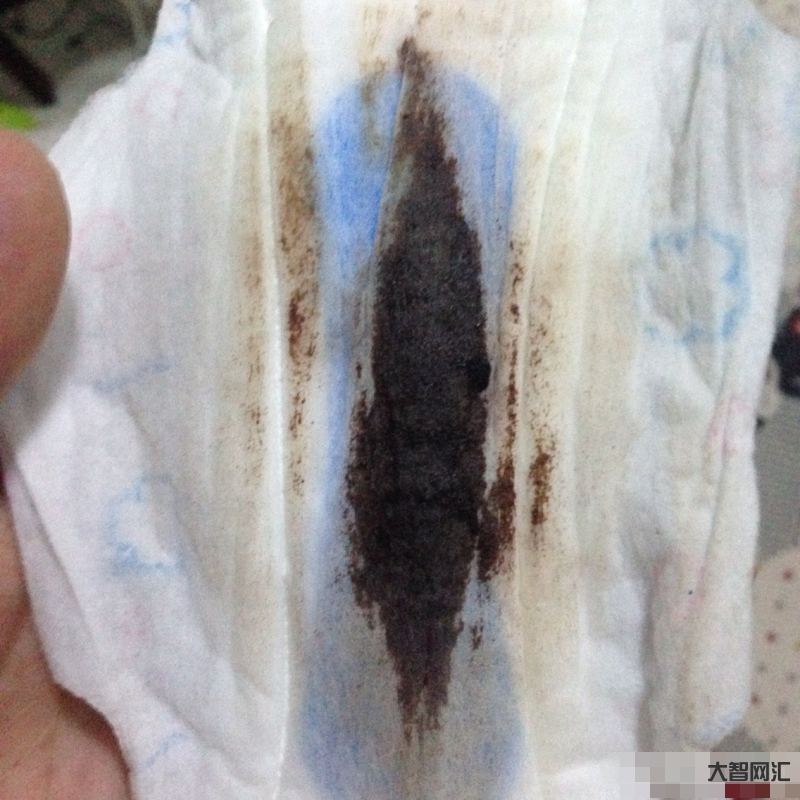 月經量少顏色黑褐色是什么原因-月經發黑量少怎么調理? 月經量少顏色黑褐色是什么原因-月經發黑量少怎么調理?