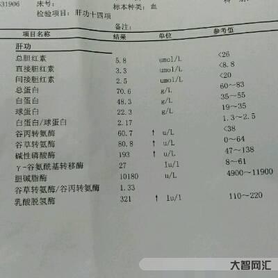 谷草轉氨酶高是什么情況-轉氨酶高不可大意,是肝臟的警示,轉氨酶高有方法 谷草轉氨酶高是什么情況-轉氨酶高不可大意,是肝臟的警示,轉氨酶高有方法