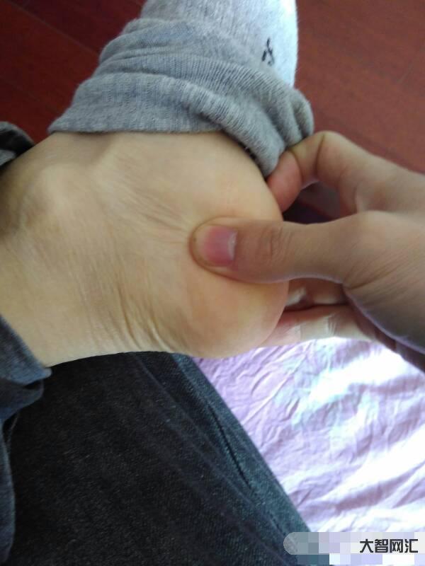 腳后跟疼是什么原因引起的怎么治-經常腳后跟痛，原因找到了，4個疾病因素