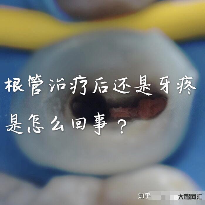 根管治療多少錢一顆牙-為啥根管治療這么貴，是不是被坑了?