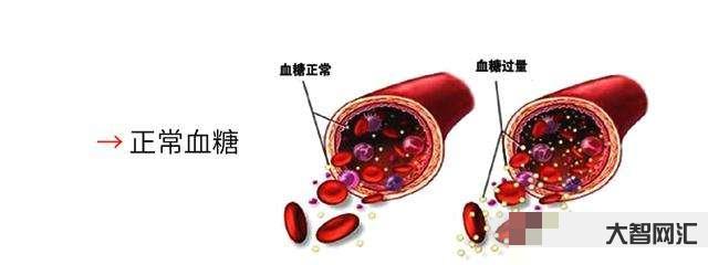 血糖高的癥狀有哪些癥狀-糖尿病患者注意:判斷自己病情是否加重,這4個信 血糖高的癥狀有哪些癥狀-糖尿病患者注意:判斷自己病情是否加重,這4個信