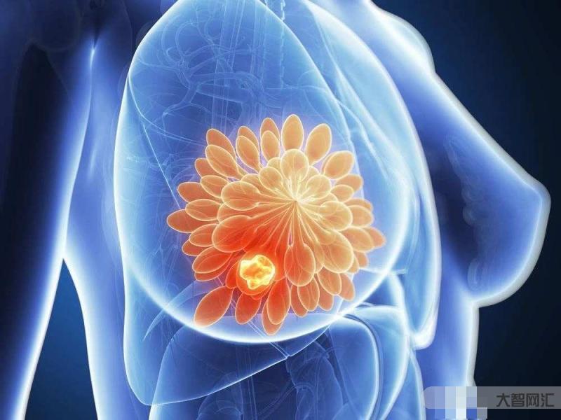 乳腺增生的主要癥狀有哪些-乳腺增生有哪些癥狀? 乳腺增生的主要癥狀有哪些-乳腺增生有哪些癥狀?