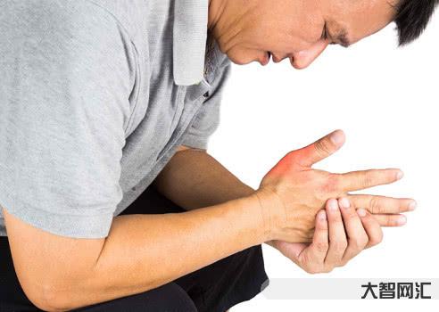 痛風會在哪些部位痛-痛風可不僅是關節痛，背后的這個問題別大意