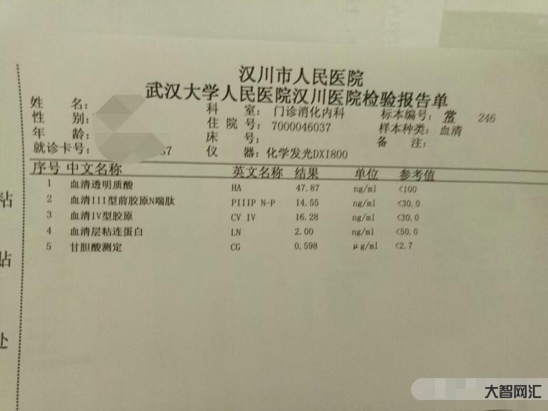 肝功能檢查主要看哪幾項指標-肝功能化驗單怎么看?這3個指標記住,不用問 肝功能檢查主要看哪幾項指標-肝功能化驗單怎么看?這3個指標記住,不用問