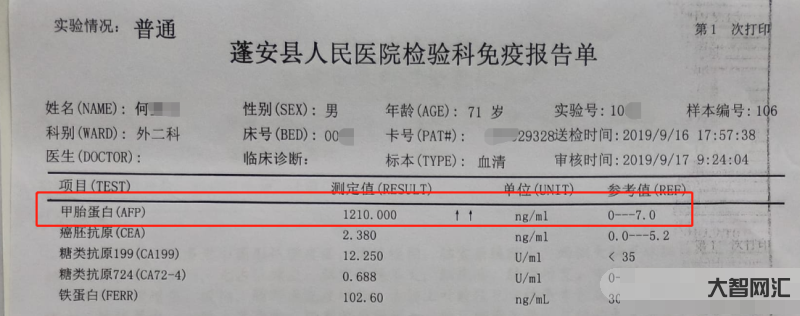 甲胎蛋白偏高說(shuō)明什么問(wèn)題-甲胎蛋白升高不一定是肝癌!但很可能有這幾種情 甲胎蛋白偏高說(shuō)明什么問(wèn)題-甲胎蛋白升高不一定是肝癌!但很可能有這幾種情
