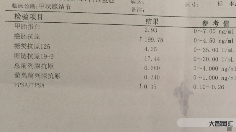 癌胚抗原偏高說明什么-腫瘤標志物升高就代表患癌嗎?發現腫瘤標志物升高時 癌胚抗原偏高說明什么-腫瘤標志物升高就代表患癌嗎?發現腫瘤標志物升高時